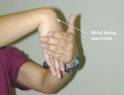 carpal tunnel syndrome  - exercise 2 - wrist extention
